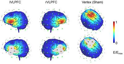 Different Roles of the Left and Right Ventrolateral Prefrontal Cortex in Cognitive Reappraisal: An Online Transcranial Magnetic Stimulation Study